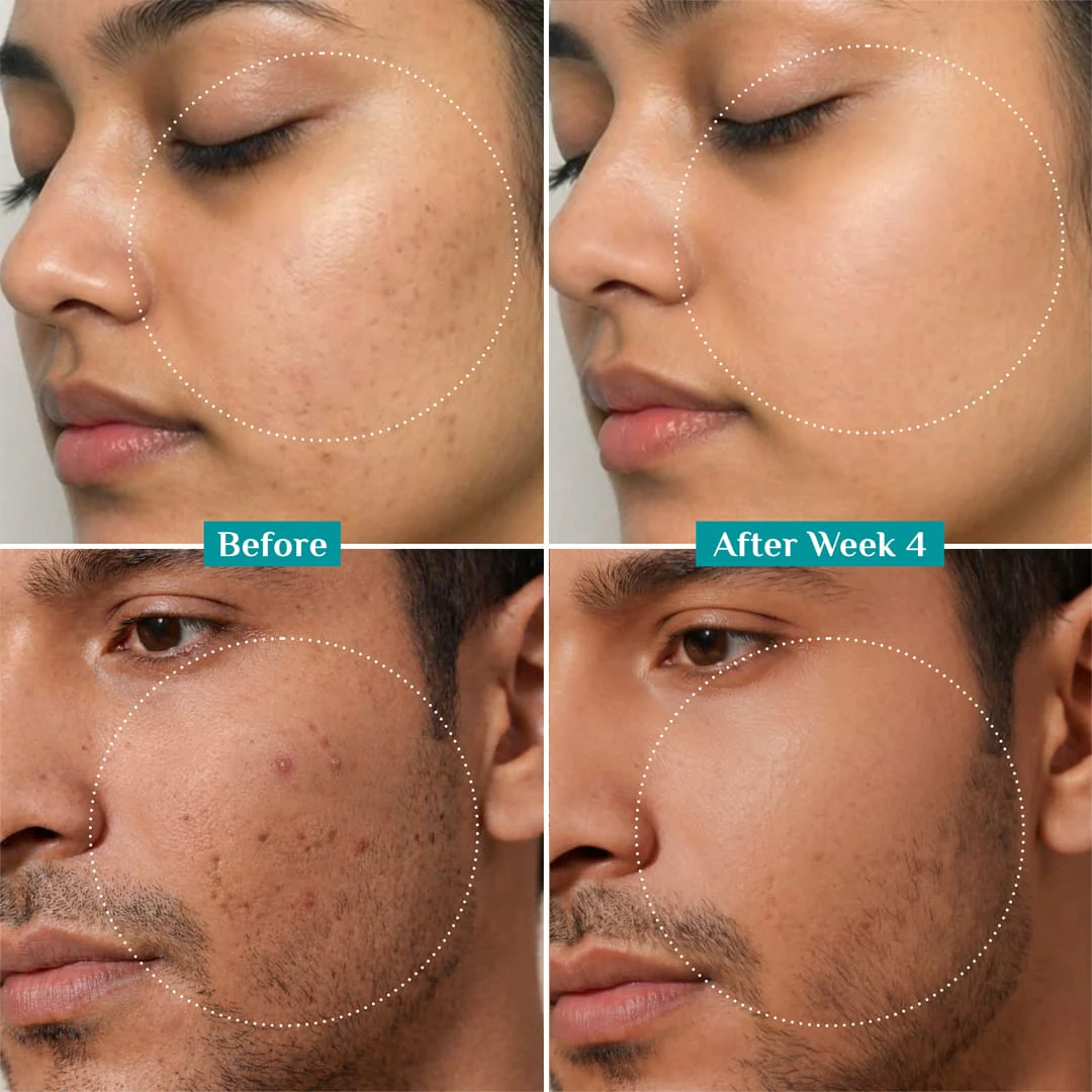 10% Niacinamide Face Serum With Kojic Acid & Korean Rice Water - Image 8