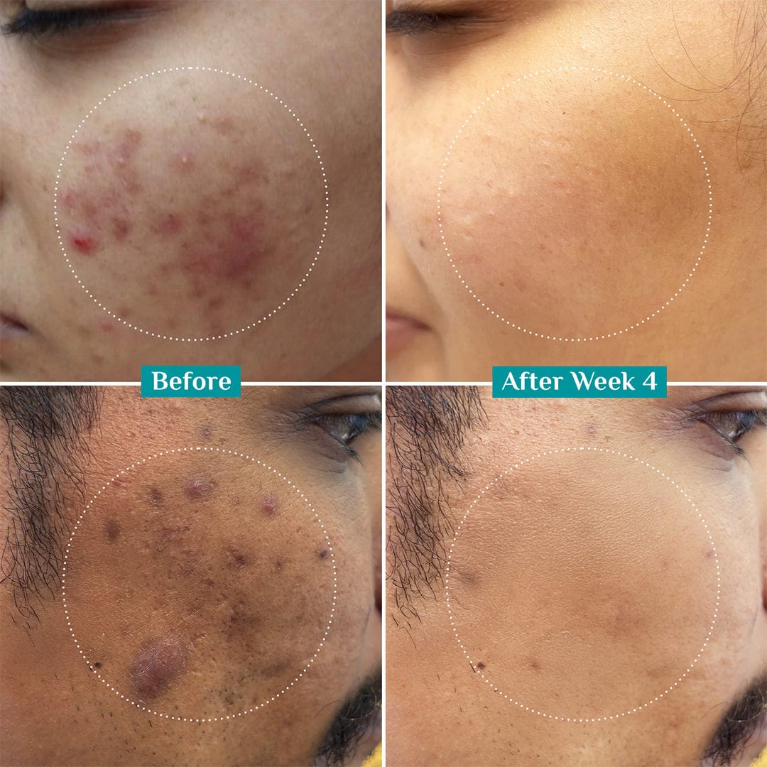 10% Niacinamide Face Serum With 1% Zinc PCA - Image 6