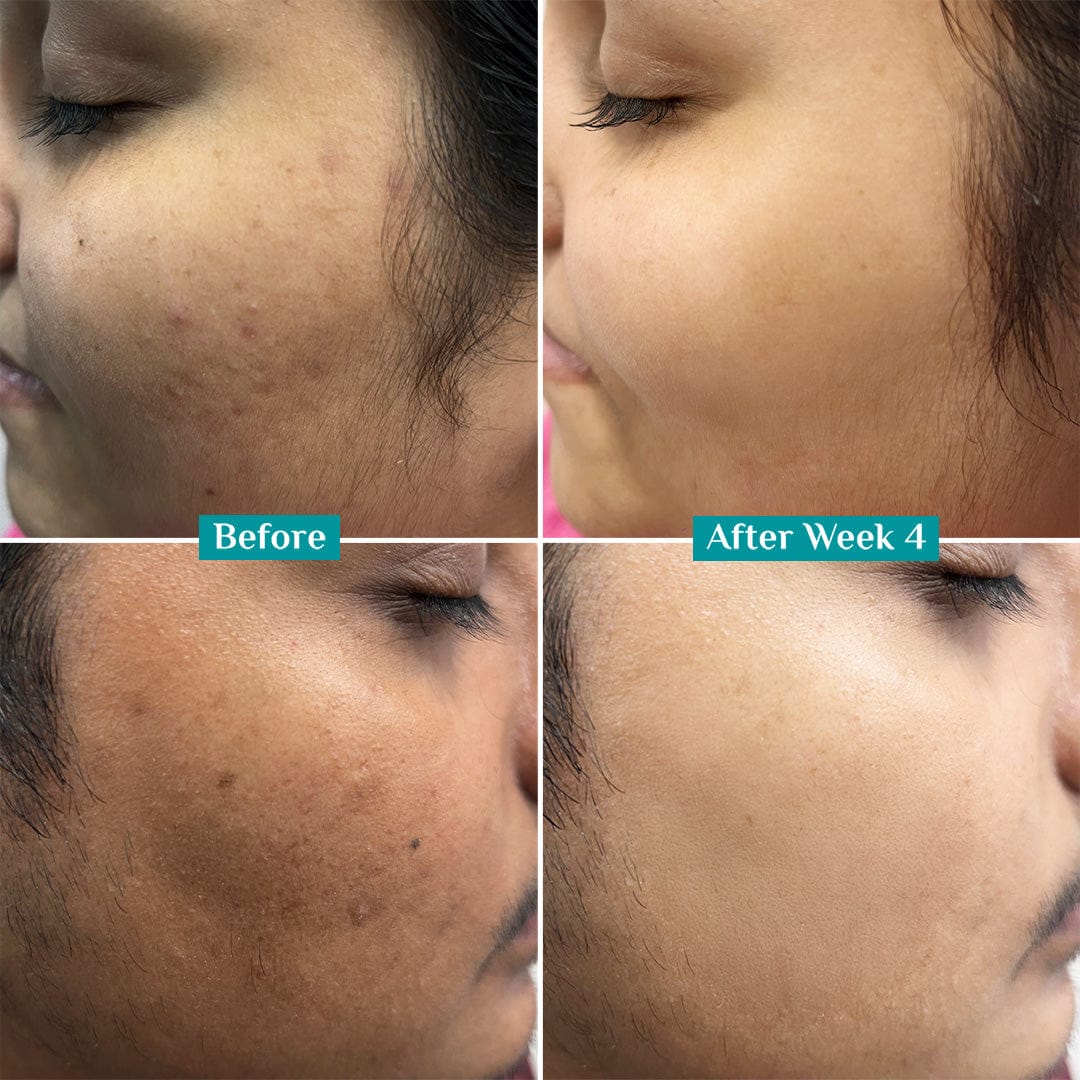 10% Vitamin C Face Serum For Daily Brightness - Image 6