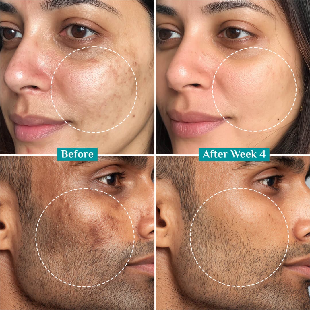 15% Vitamin C Face Serum For Advanced Brightness (20 ml) - Image 8