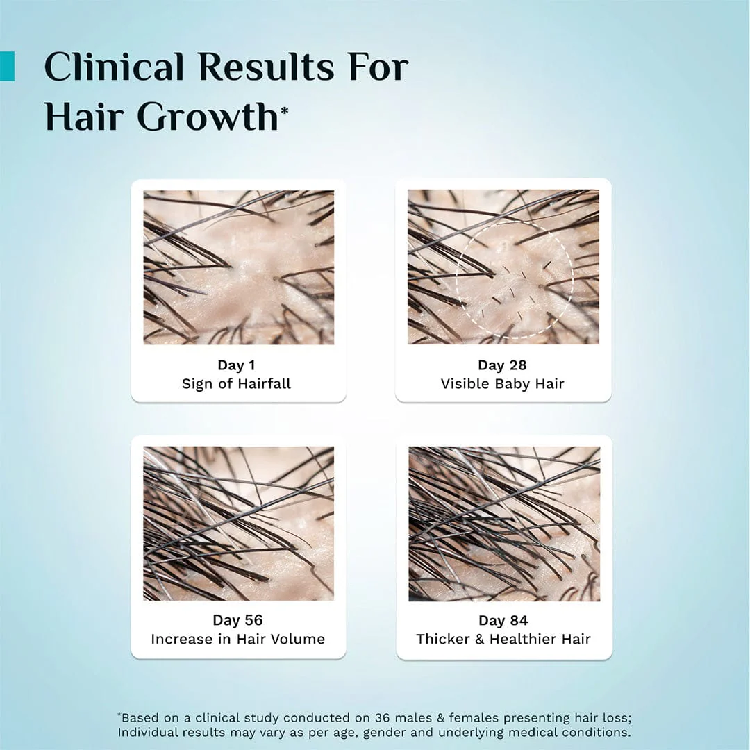3% Redensyl & 4% Anagain Advanced Hair Growth Serum 100 ml - Image 10