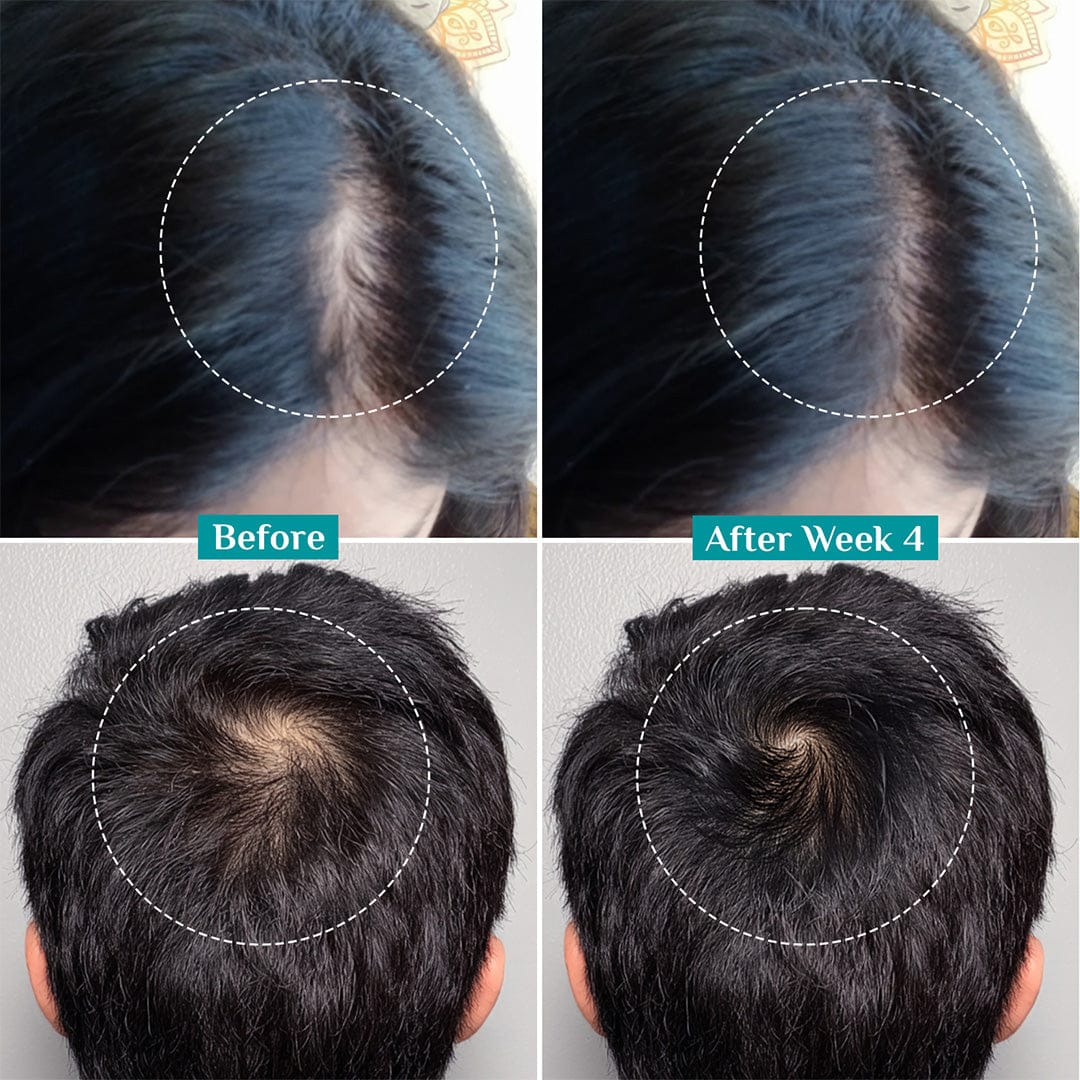 3% Redensyl & 4% Anagain Advanced Hair Growth Serum 100 ml - Image 8