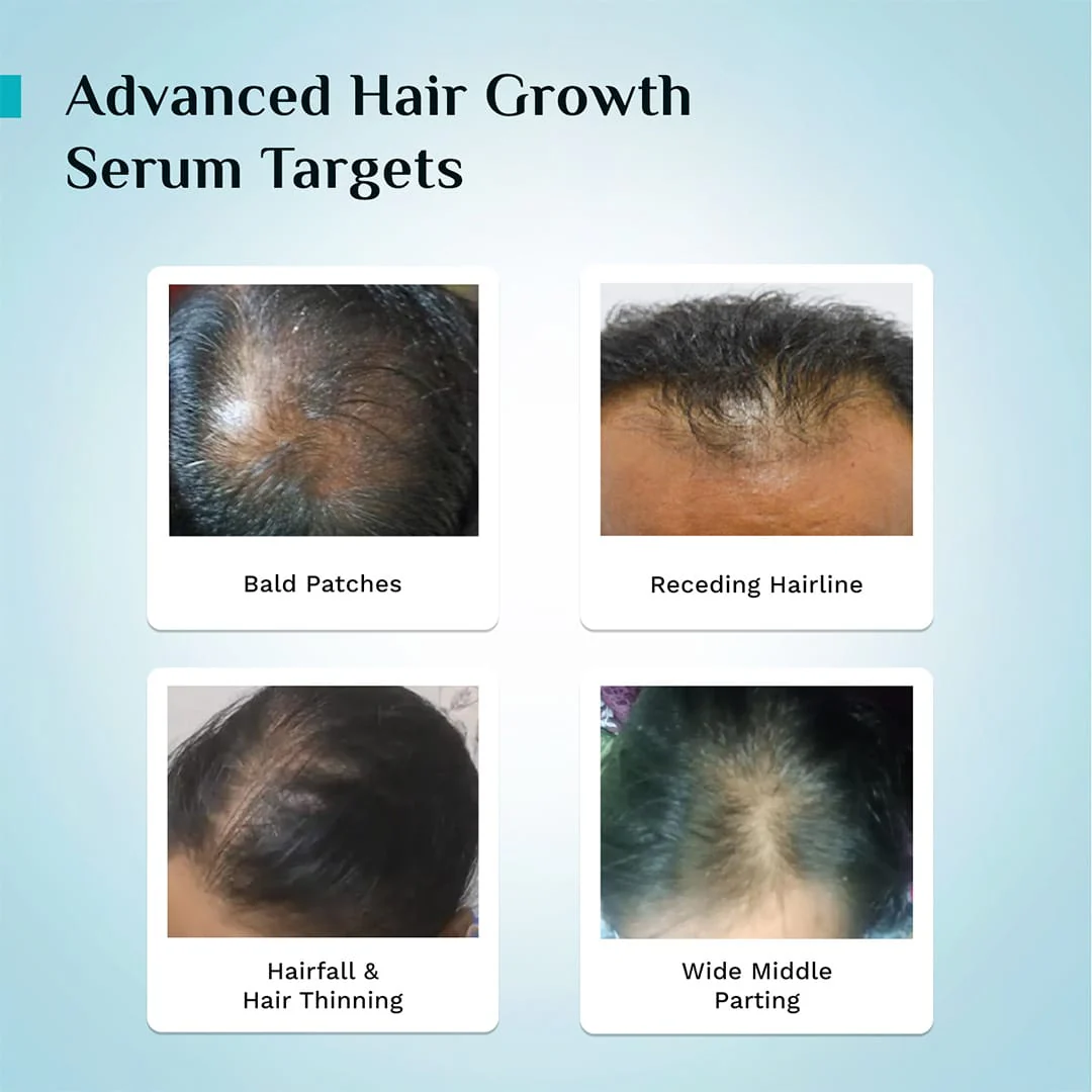 3% Redensyl, 4% Anagain & 5% Capilia Stem Cell Complex Advanced Hair Growth Serum - Image 35