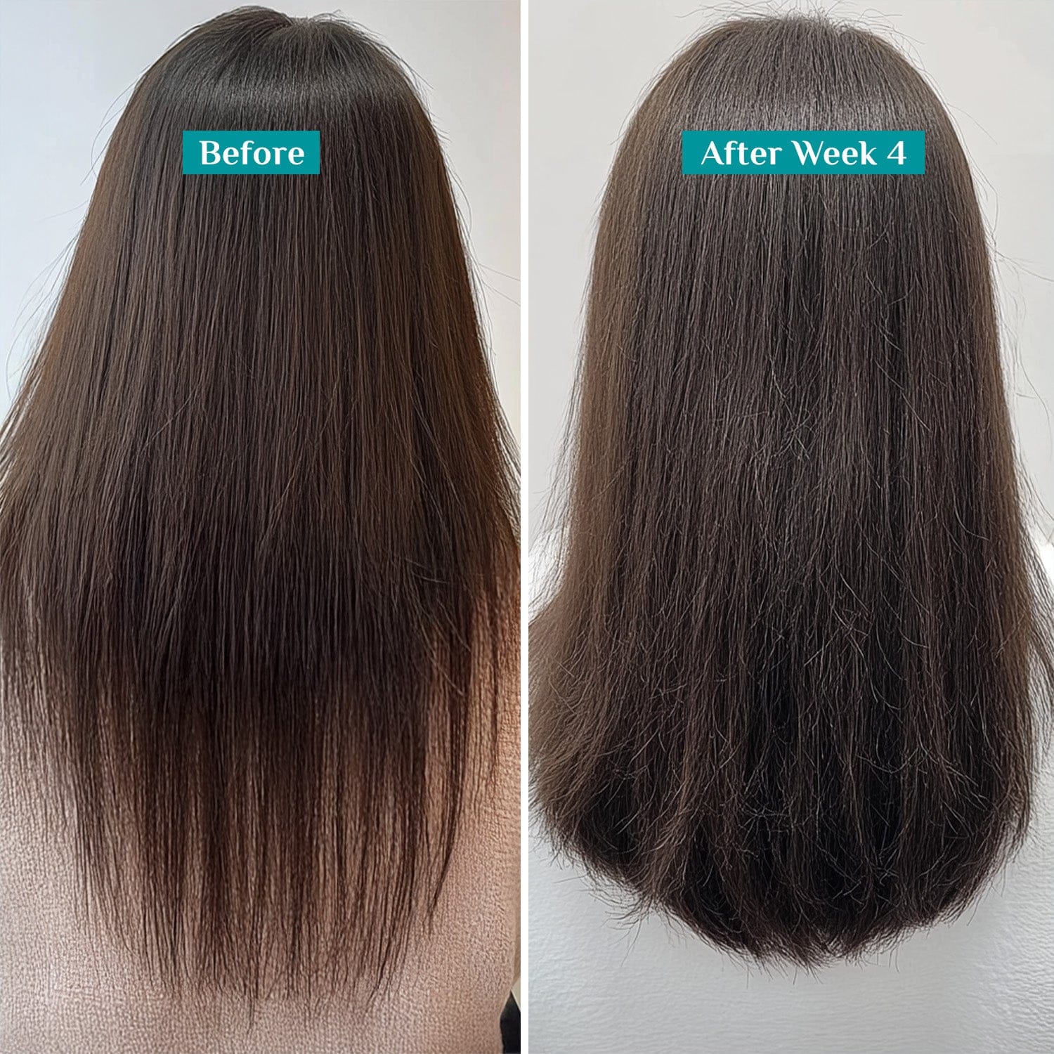 Redensyl & Anagain Hairfall Control Shampoo - Image 8